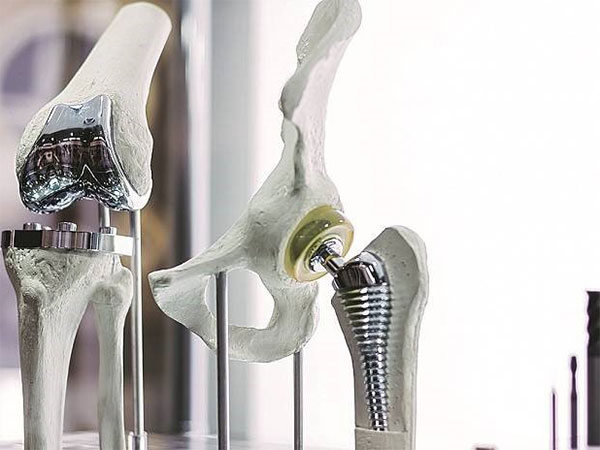 Artificial bone joints, biological implant solutions